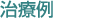 ���×�